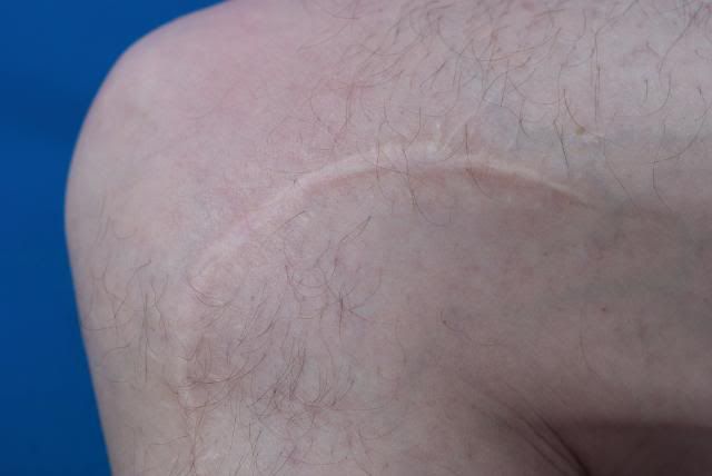 scars-9-of-9.jpg